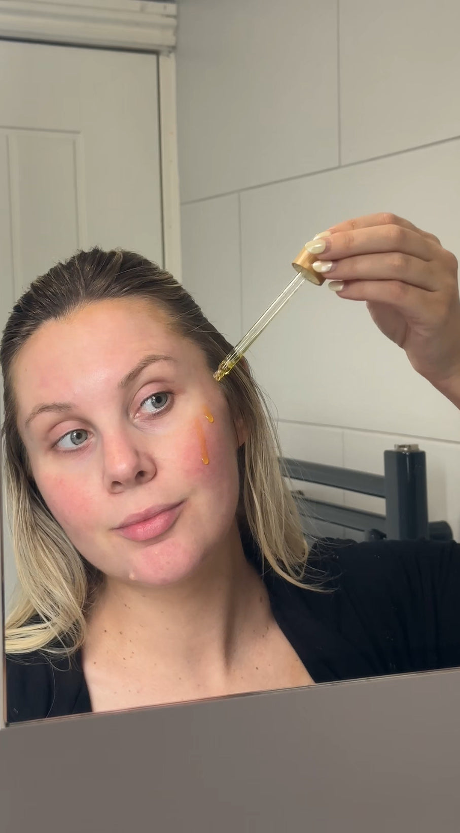 Why Is My Skin Breaking Out? It Might Be Your Skin Barrier